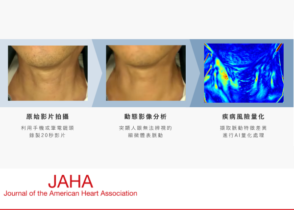 NTU Develops World's First Rapid Imaging &amp; Screening Technology for Stroke